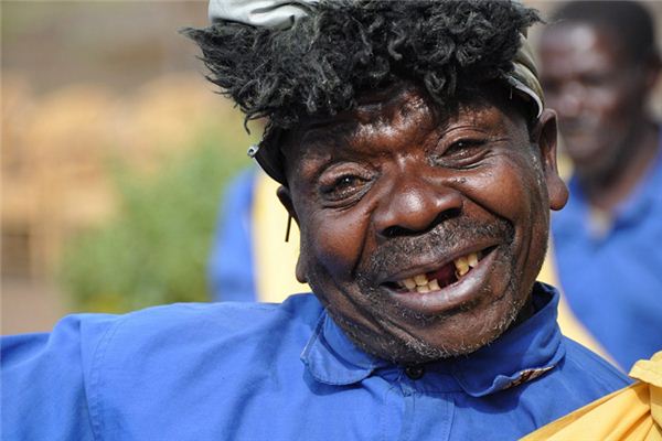 梦见牙齿黑了是什么意思 梦见牙齿黑了是什么意思