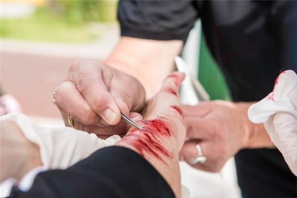 梦见手臂流血是什么意思 梦见手臂流血是什么意思