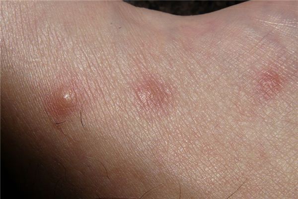 梦见身上痒是什么意思